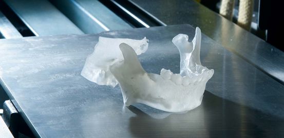 3D modelling makes surgery easier