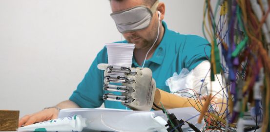 Thought- controlled prostheses
